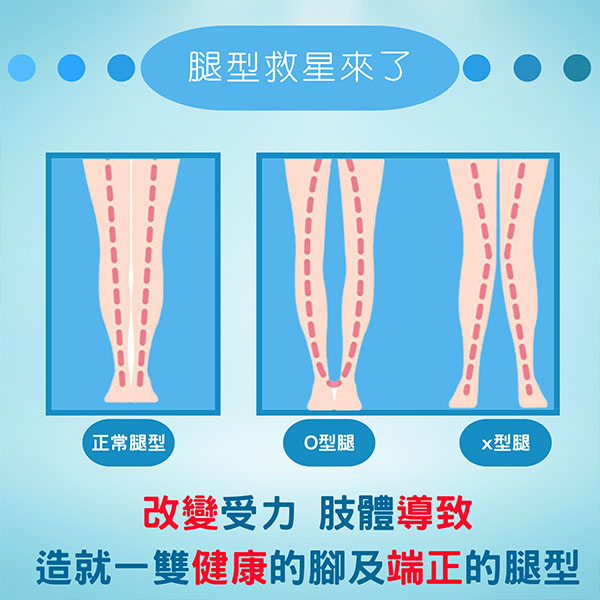 雙腿不夠直，O型腿、X型腿，K型腿或假性長短腳等困擾